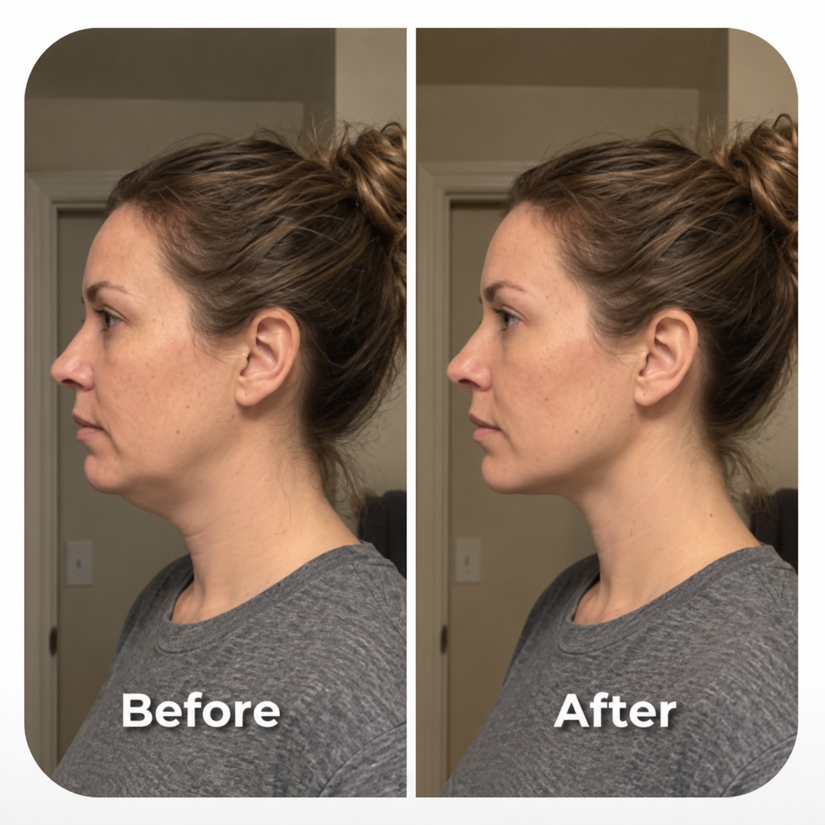 Aeki facial massage before and after side profile comparison